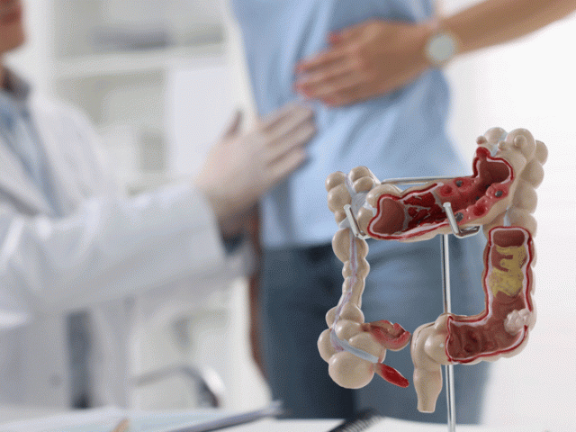 Phát hiện mắc ung thư đại tràng từ sắc mặt xấu