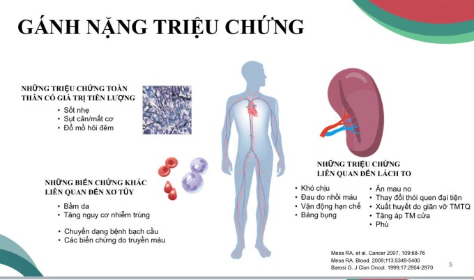 Dấu hiệu của bệnh xơ tủy. Ảnh: Bệnh viện cung cấp
