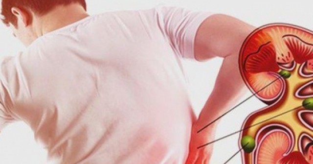 5 dấu hiệu cảnh báo bệnh thận mạn tính: Đừng bỏ qua nếu sáng dậy thấy bất thường này