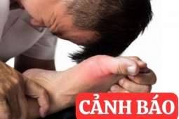 Tin tức sức khỏe - 6 thói quen cực nguy hiểm tàn phá xương khớp cần dừng lại ngay lập tức!