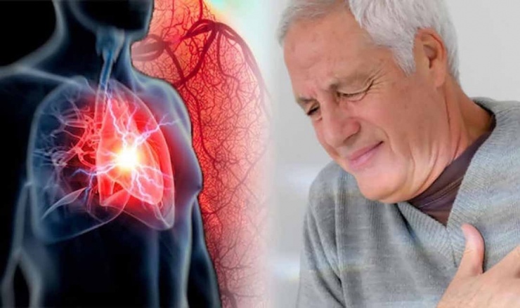Tức ngực: Đây là dấu hiệu thông thường nhất của các nguy cơ liên quan đến tim. Nếu bạn có một động mạch bị tắc hoặc là có một cơn đau tim, bạn có thể cảm thấy đau, tức, hoặc nặng ngực. Cảm giác này thường kéo dài trong vài phút và có thể xuất hiện lúc bạn nghỉ ngơi hoặc lúc bạn hoạt động thể chất. Ảnh minh họa: Internet