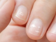 Trên tay xuất hiện 5 thay đổi, coi chừng là tín hiệu ung thư