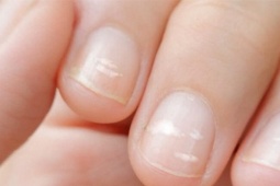 Sức khỏe đời sống - Trên tay xuất hiện 5 thay đổi, coi chừng là tín hiệu ung thư