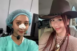 Làm đẹp - 'Em xinh' Quỳnh Anh Shyn khiến fan xôn xao khi tiết lộ phẫu thuật thẩm mỹ