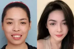 Làm đẹp - 10 năm sau ca phẫu thuật 'đổi đời', Vũ Thanh Quỳnh giờ ra sao?