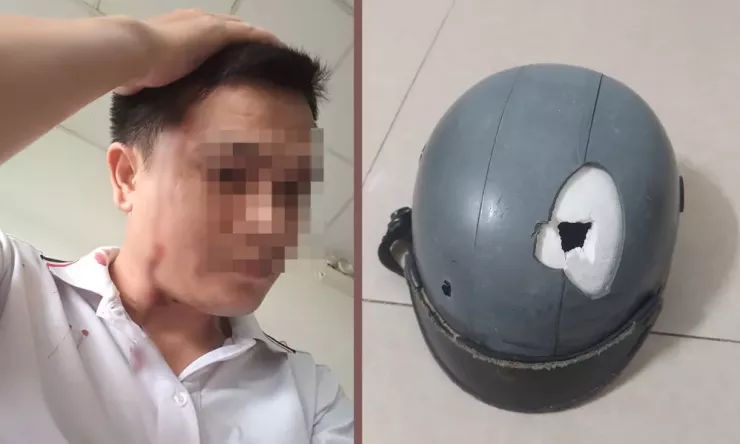 Anh T bị thương sau khi bị đánh vào vùng đầu, vỡ nón bảo hiểm. Ảnh: HT