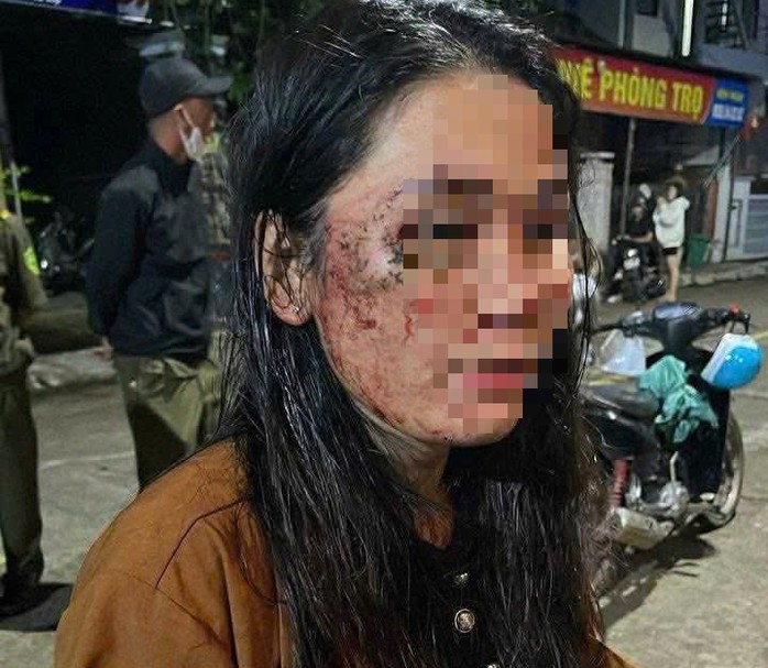 Chị T.L.T.H. tố cáo gia đình khách hàng hành hung
