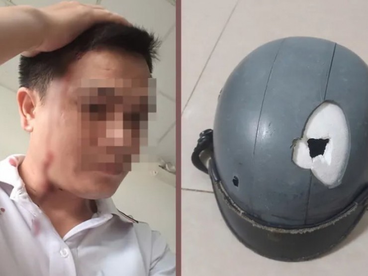 Công an triệu tập người dùng cây sắt đánh vỡ nón bảo hiểm người đi đường