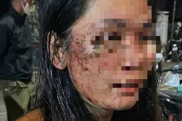 Tin tức trong ngày - Nữ shipper tố bị khách hàng hành hung