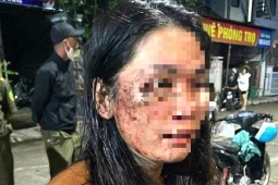 Tin tức trong ngày - Diễn biến mới vụ nữ shipper tố bị khách hàng hành hung