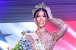 Thời trang - Hoa hậu bị trộm 2 tỷ đồng trang sức và túi xách khi đi du lịch