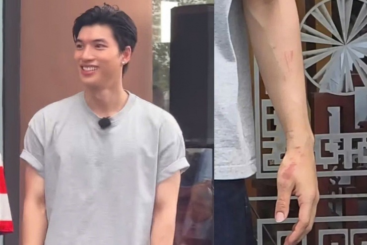 Vết thương trên tay của HIEUTHUHAI khiến nhiều fan lo lắng.