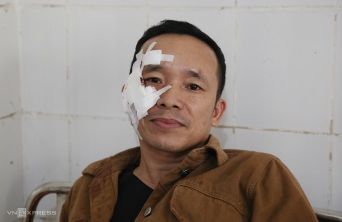 Anh Lê Văn Phước bị băng bó gần nửa khuôn mặt do một mảnh kính văng trúng. Ảnh: Đắc Thành