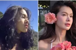 Cô gái Việt là 'nhân chứng' cho sự thay đổi cuộc sống nhờ 'dao kéo'
