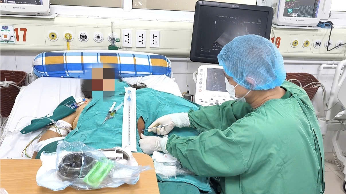 Bác sĩ chọc hút dịch màng phổi cho bệnh nhân.&nbsp;