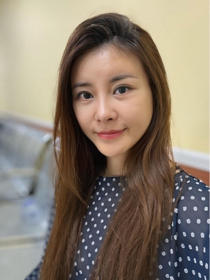 Mặt mộc của Kim Oanh sau 2 tháng phẫu thuật thẩm mỹ. Nữ diễn viên cho biết cô hạ thấp sống mũi vì yếu tố "phong thủy", giúp diện mạo cô trở nên mềm mại, hài hòa hơn.