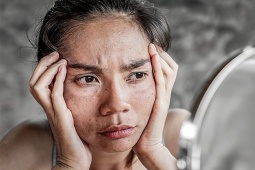 Làn da sau 30 lão hóa nhanh nếu thiếu 5 hoạt chất quan trọng