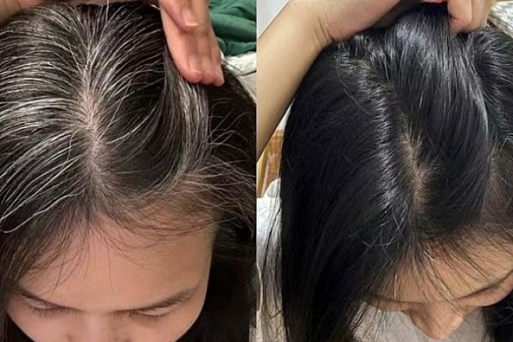 Có thể đảo ngược tóc bạc thành đen được không?