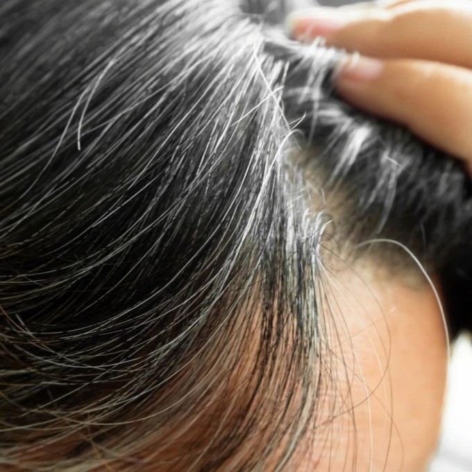 Tóc bạc là một trong những biểu hiện của lão hóa tự nhiên, thời điểm xuất hiện tóc bạc phụ thuộc nhiều vào hoàn cảnh, sức khỏe, gen...