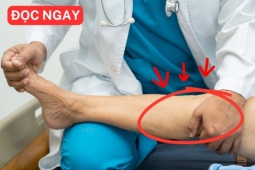 Tin tức sức khỏe - Không ngờ: Loại đạm đặc biệt trong Protein Bách Niên Kiện lại là ‘chìa khóa’ cho xương khớp dẻo dai