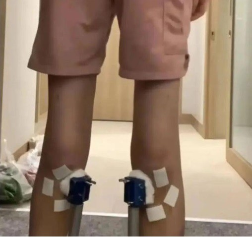 Dịch vụ tăng chiều cao vật lý