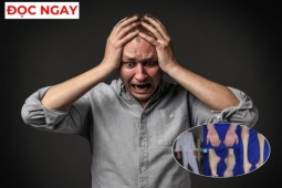Tin tức sức khỏe - Đừng bỏ qua: 3 biểu hiện lạ ở người đau nhức xương khớp cảnh báo cơ thể đang suy kiệt