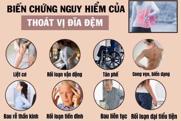 Đau lưng, mỏi vai gáy, tê bì chân tay “đeo bám” - Tố cáo bạn “phạm” sai lầm này! - 3