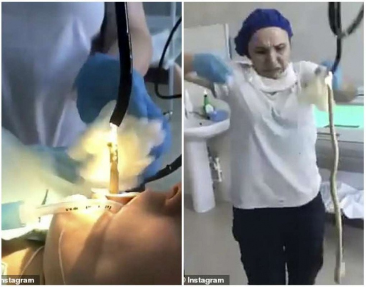 Không ngờ, vị bác sĩ đã kéo ra một sinh vật dài ngoằng, trơn tuột – một con rắn thực thụ.