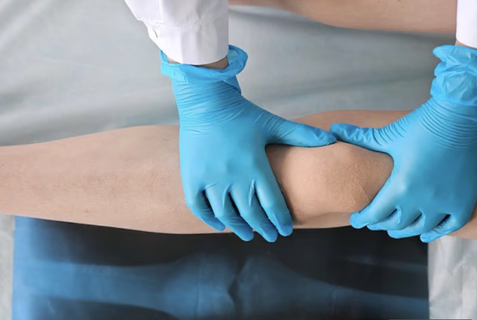 Một số người mặc cảm vì chiều cao đã phẫu thuật "cắt xương" để được thấp hơn. Ảnh minh họa: Shutterstock