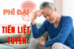Tin tức sức khỏe - 5 đối tượng có khả năng cao mắc phì đại tuyến tiền liệt khi về già, nam giới chớ chủ quan