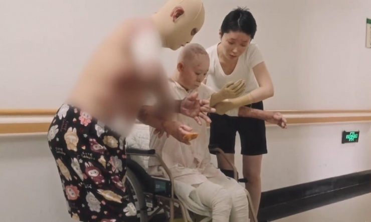 Mẹ Đồng Dao bị thương tật nặng nhất. Bà vẫn chưa thể đi lại bình thường, cần hỗ trợ từ chồng và con gái.