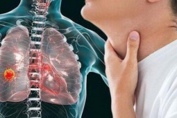 Người đàn ông 60 tuổi bất ngờ phát hiện ung thư phổi từ dấu hiệu nhiều người Việt mắc phải, nhưng đều bỏ qua