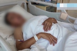 Tự giác hơi chữa đau lưng, người đàn ông liệt nửa người