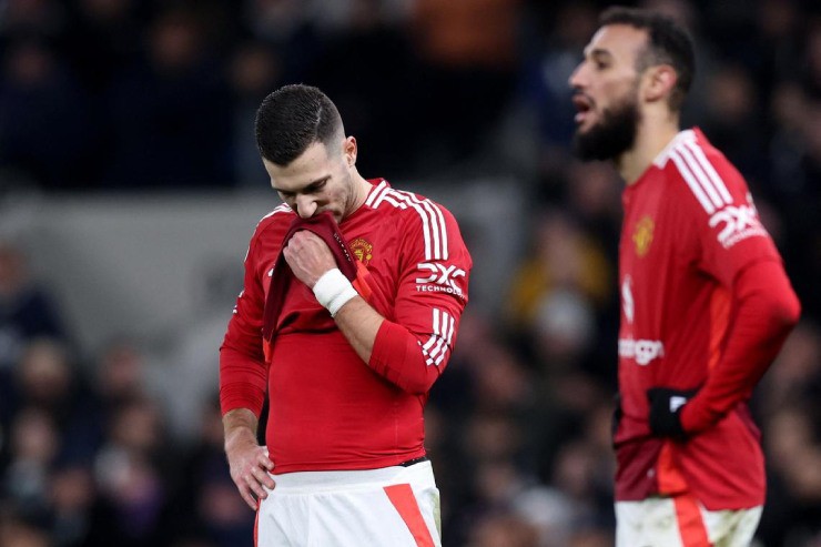 Các cầu thủ MU ngao ngán với hệ thống 3-4-2-1