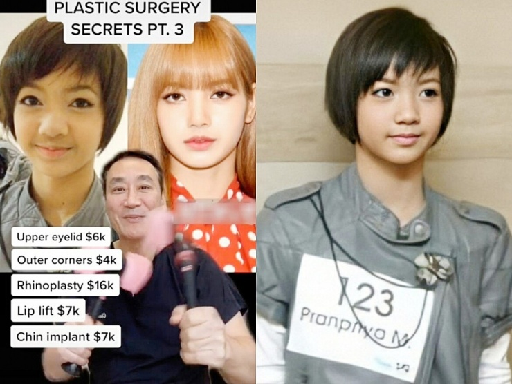 Bí ẩn nhan sắc Lisa của BLACKPINK: Đỉnh cao nghệ thuật trang điểm hay phẫu thuật? - 4