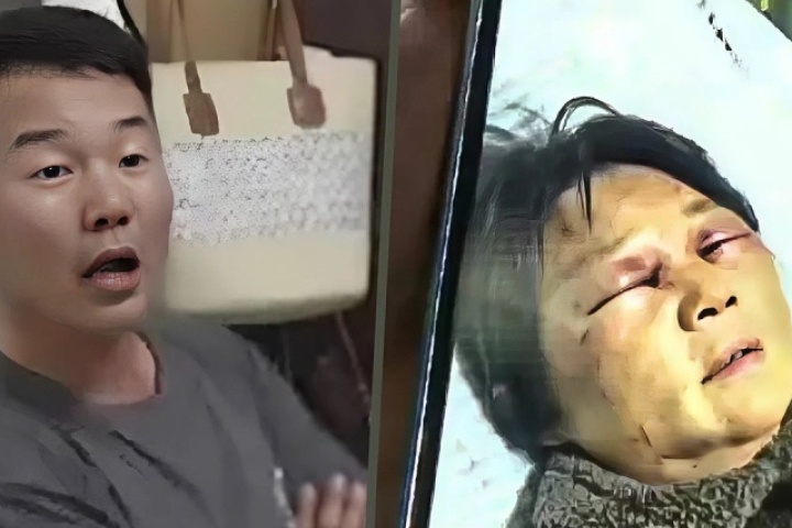 Con dâu hành hung mẹ chồng gãy xương sườn vì không chăm cháu