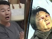 Con dâu hành hung mẹ chồng gãy xương sườn vì không chăm cháu