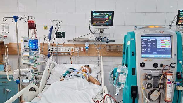 Người bệnh phải thở máy, lọc máu với tình trạng tan máu cấp. Ảnh: Bệnh viện Bạch Mai