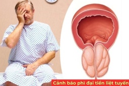 Tin tức sức khỏe - Có 1 trong 3 dấu hiệu này, quý ông nên kiểm tra tuyến tiền liệt càng sớm càng tốt!
