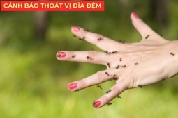 Tin tức sức khỏe - Tự kiểm tra nguy cơ thoát vị đĩa đệm nhờ 3 dấu hiệu xuất hiện ngay sau khi ngủ dậy