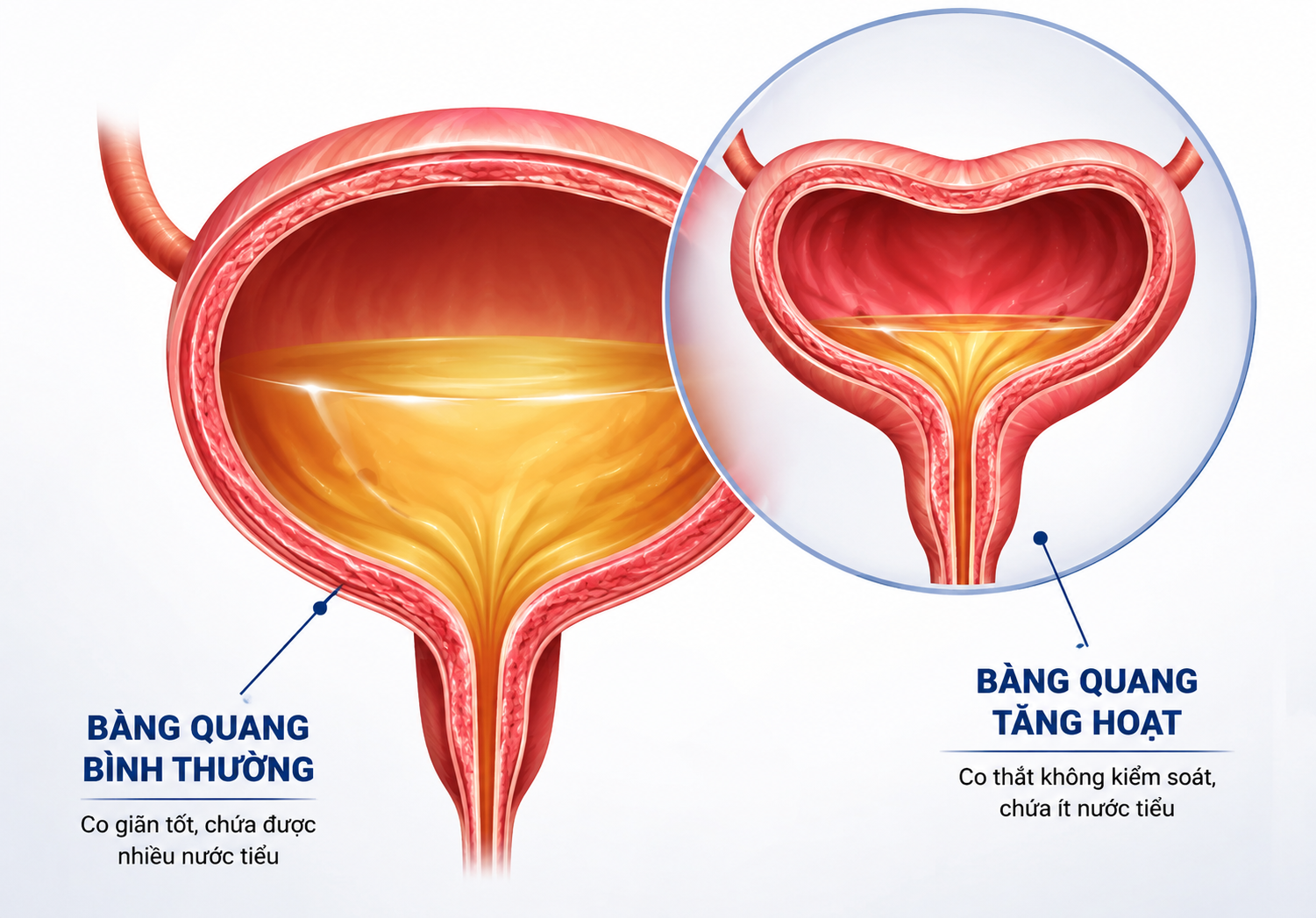 Ích Niệu Khang: Hành trình đồng hành cùng hàng ngàn người bị tiểu đêm, tiểu nhiều lần do bàng quang tăng hoạt - 1