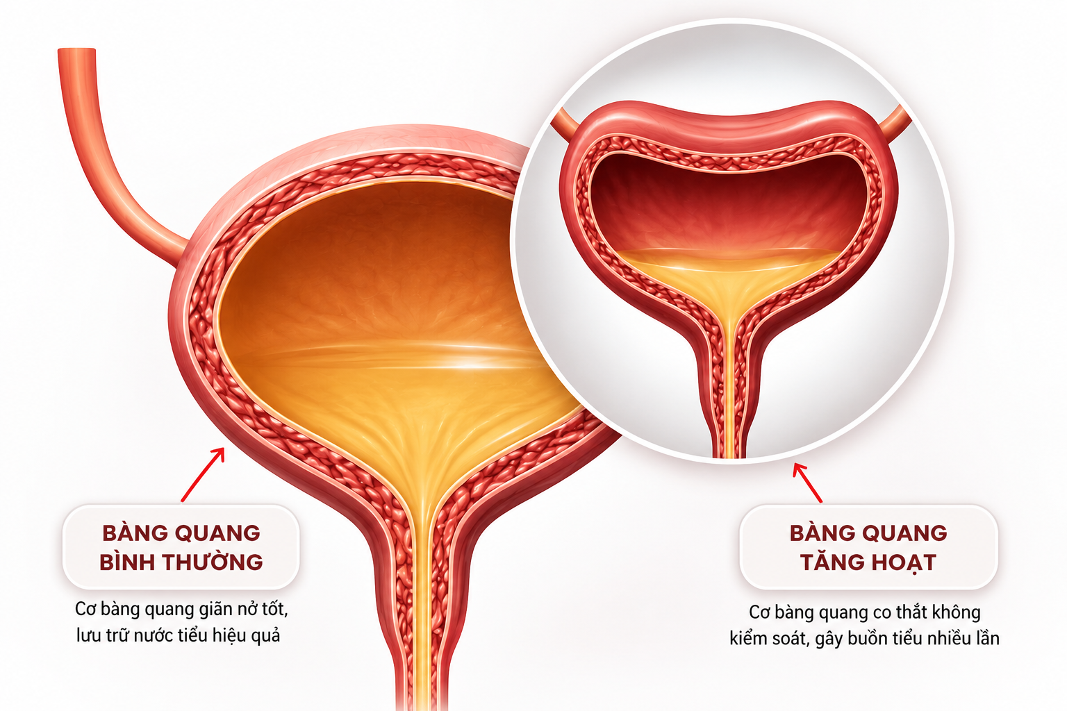 Cảnh báo: 4 thói quen âm thầm "tiếp tay" cho chứng tiểu đêm, tiểu són ở tuổi trung niên - 2