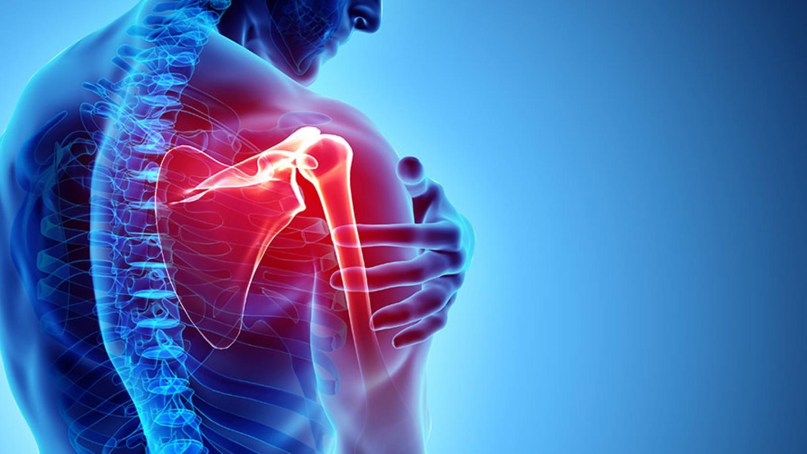 Tự kiểm tra nguy cơ thoát vị đĩa đệm nhờ 3 dấu hiệu xuất hiện ngay sau khi ngủ dậy - 2