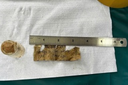 Từ mảnh giấy trong lọ penicillin, xác định được danh tính liệt sĩ sau hơn 50 năm