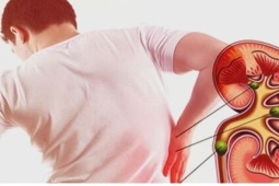 3 nhóm người có nguy cơ suy thận cao nhưng thường chủ quan