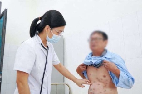 Ngứa điên tưởng viêm da, nào ngờ bệnh mãn tính nguy hiểm