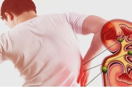 3 nhóm người có nguy cơ suy thận cao nhưng thường chủ quan