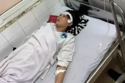 Điều dưỡng trưởng bệnh viện bị nhóm người hành hung nhập viện: Bộ Y tế chỉ đạo "nóng"