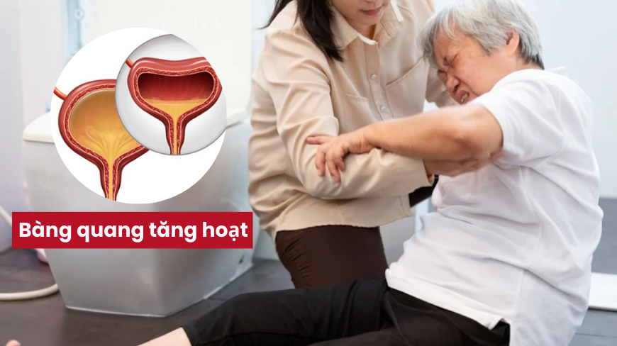 Chuyên gia cảnh báo: Tiểu đêm kéo dài không nên chỉ đổ lỗi cho tuổi già! - 2