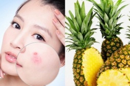 Bí quyết sở hữu làn da căng bóng, mịn màng chỉ nhờ một quả dứa